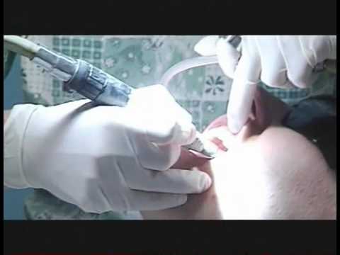 Hygiéniste dentaire - Carrières en santé et en services sociaux