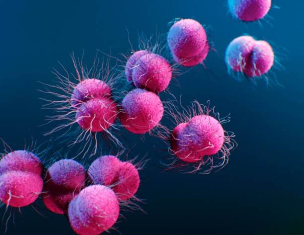 gonorrhea symptoms