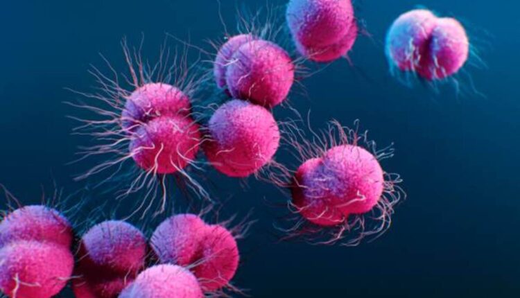 gonorrhea symptoms