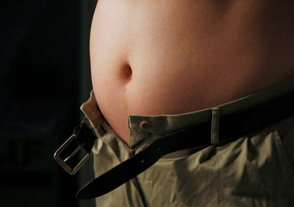 metabolic syndrome