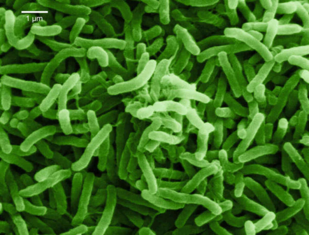 what is cholera
